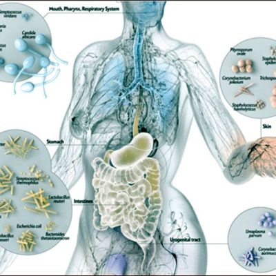 Intestino irritabile e FODMAP